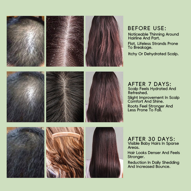 private label hair growth spray